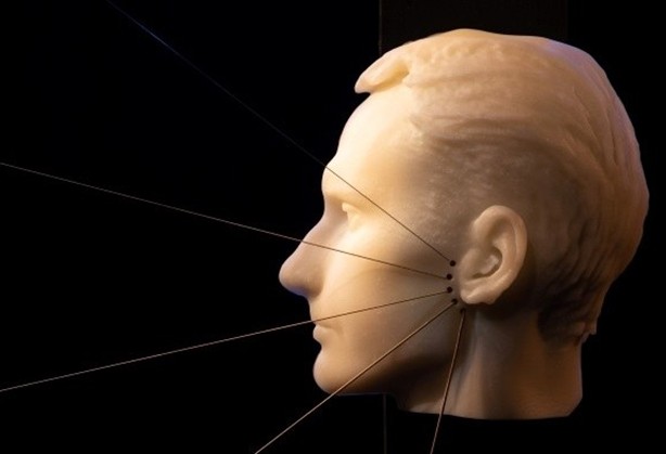 Artec Eva近距离“观察”面神经麻痹患者和脸部隐藏的情绪